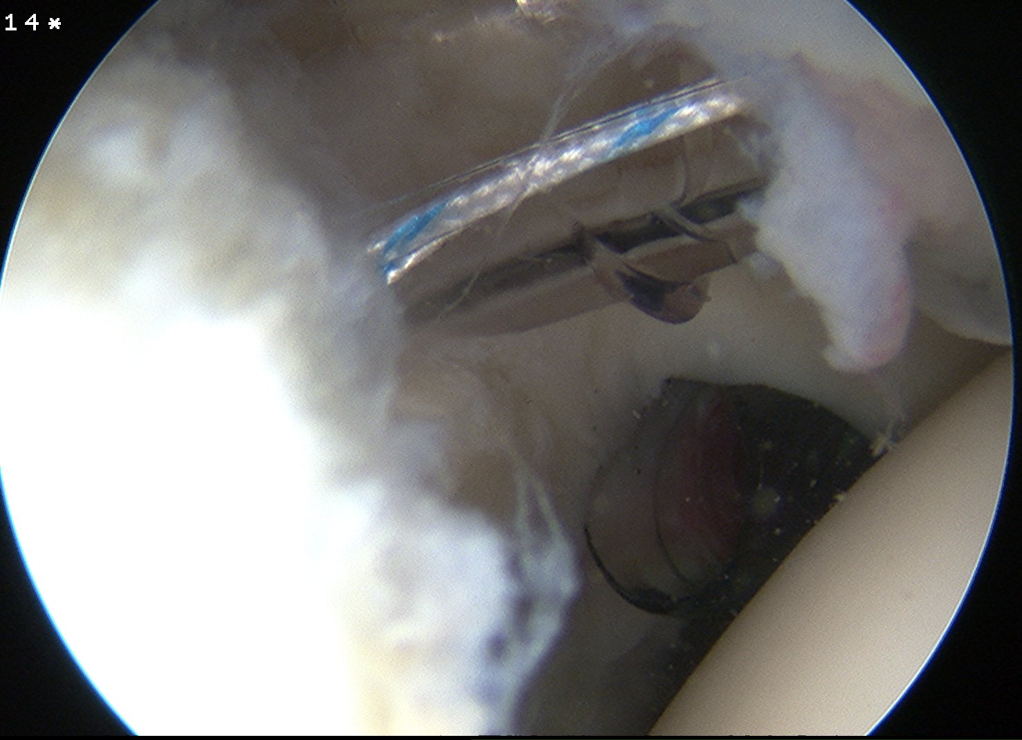 Shoulder Scope Port Wilmington 2